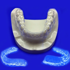 Custom Teeth Whitening Trays